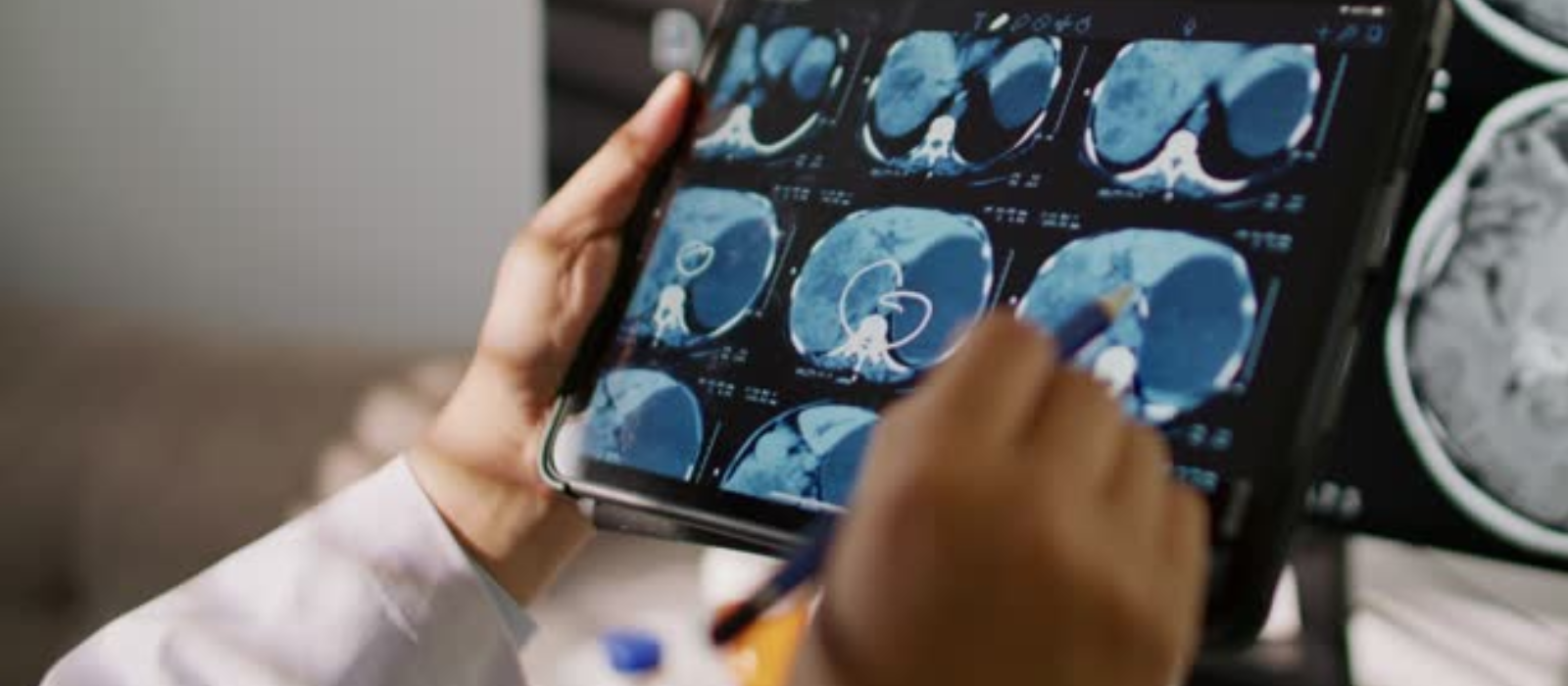 Banner brain surgeon in Gautam Buddha Nagar